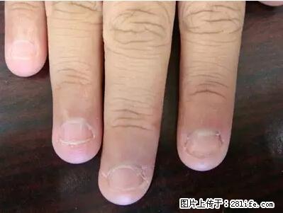 剪指甲、挖耳屎，这些日常小动作竟隐藏大危害！ - 克拉玛依生活资讯 - 克拉玛依28生活网 klmy.28life.net